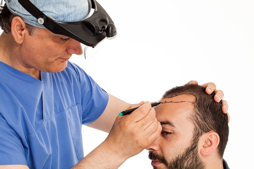 التسويق لعيادات زراعة الشعر